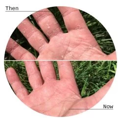 Biologi Bf Restore Face & Body Serum 20ml -Famous Skin Care Store Bf Restore Serum used 1