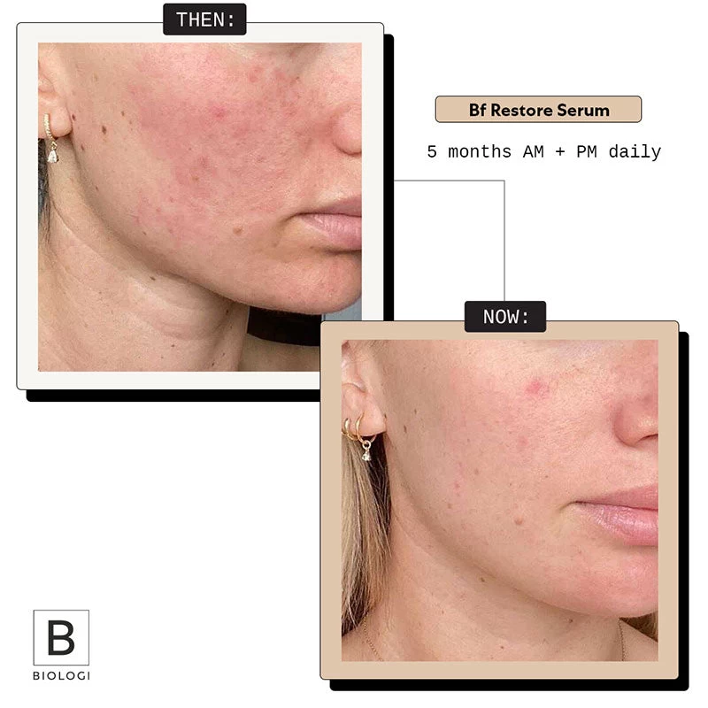Biologi Bf Restore Face & Body Serum 5ml 4 Biologi Bf Restore Face & Body Serum 5ml - Image 2