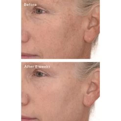 Murad Retinal ReSculpt Overnight Treatment 30ml -Famous Skin Care Store Nordstrom Retinal B A 02