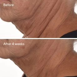 Murad Retinal ReSculpt Overnight Treatment 30ml -Famous Skin Care Store Retinal Resculpt Overnight Treatment Neck B A