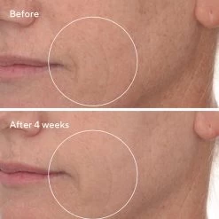 Murad Retinal ReSculpt Overnight Treatment 30ml -Famous Skin Care Store Retinal Resculpt Overnight Treatment Side B A