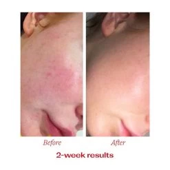 Trilogy Vitamin C Booster Treatment 15ml -Famous Skin Care Store Trilogy Vitamin C Booster Treatment 15ml lifestyle 3