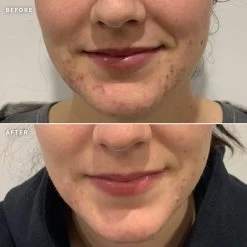 Alpha-H Clear Skin Tonic 100ml -Famous Skin Care Store alpha h clear skin tonic 1