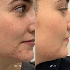 Alpha-H Clear Skin Tonic 100ml -Famous Skin Care Store alpha h clear skin tonic 2