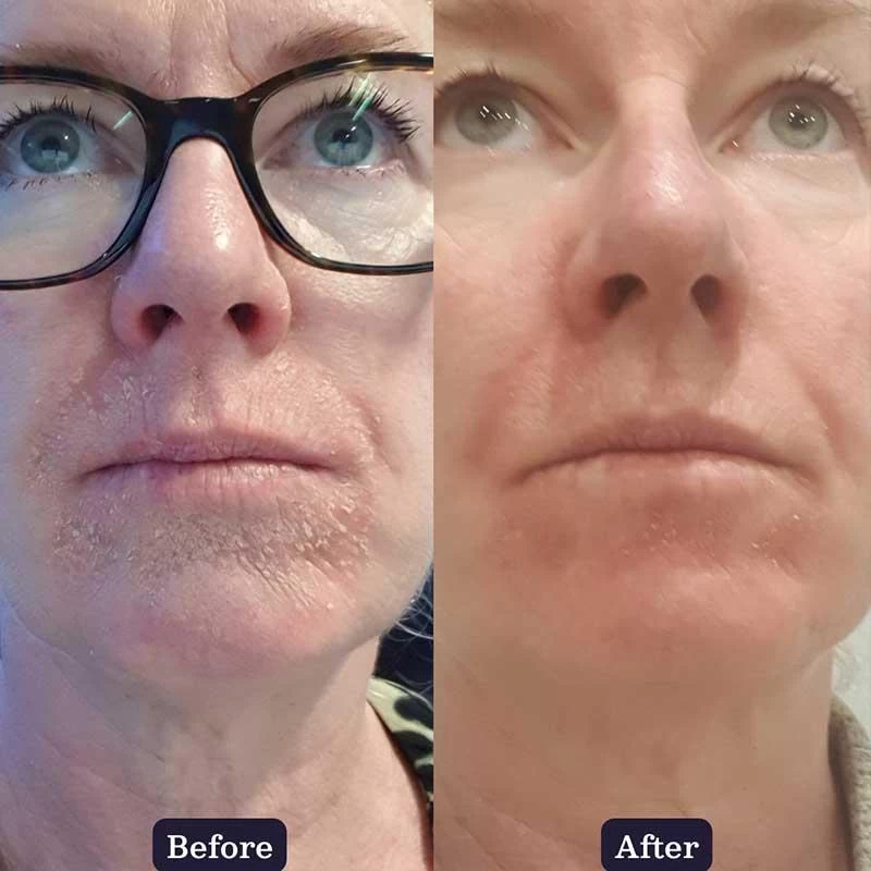 Edible Beauty & Coco Bliss Intensive Repair Creme 50ml 6 Edible Beauty & Coco Bliss Intensive Repair Creme 50ml - Image 4