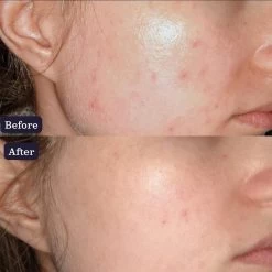 Edible Beauty Turmeric Brightening Serum 30ml -Famous Skin Care Store edible beauty turmeric brightening serum 30ml 7